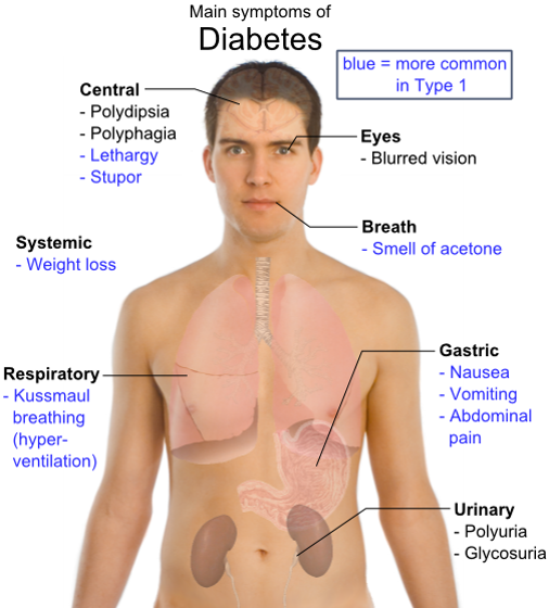 Anti Diabetics Symptoms Epidemiology Treatment Drug Dosage